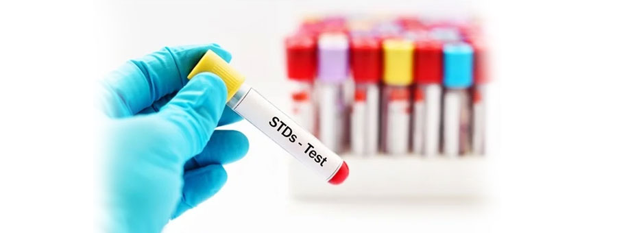 Sexually Transmitted Disease Screening